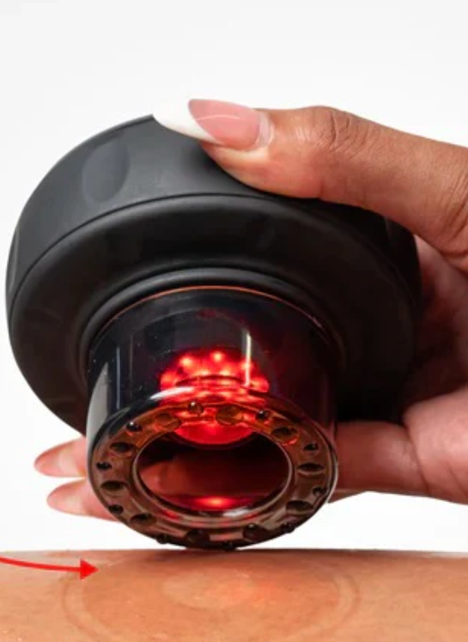 Cupsol™Smart Cupping therapy