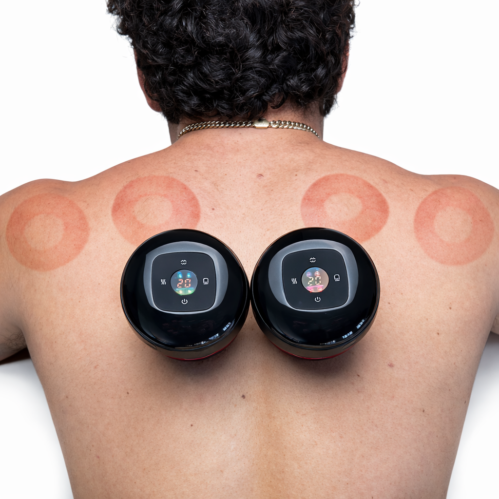 Cupsol™Smart Cupping therapy