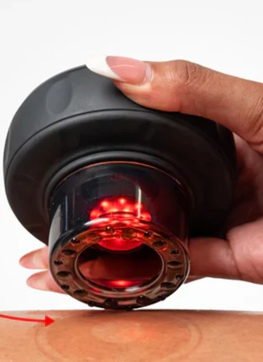 Cupsol™Smart Cupping therapy